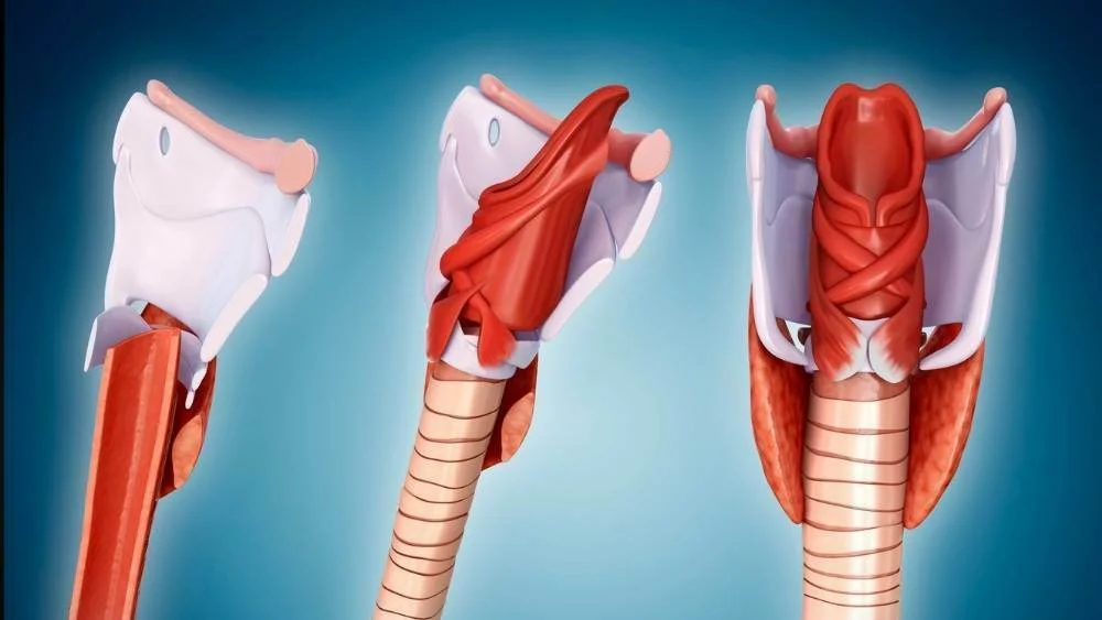 Tracheal Stenosis Surgery