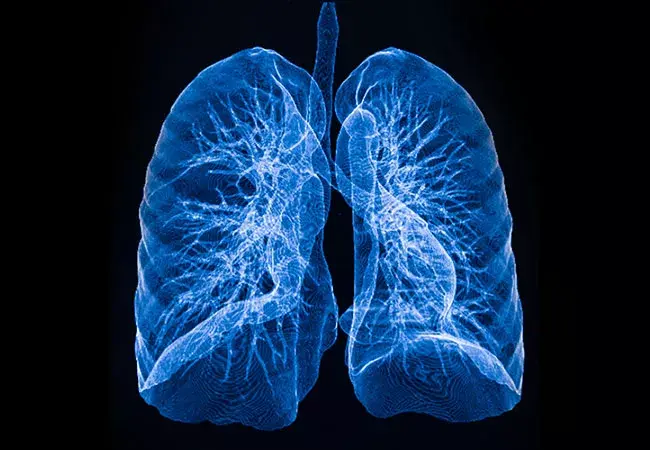 Decortication Of Lung In Bhopal